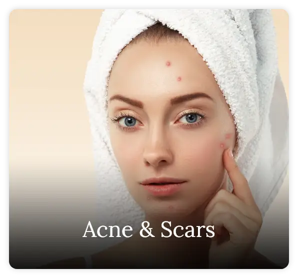 Acne & Scars