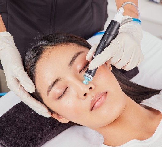 HydraFacial treatment