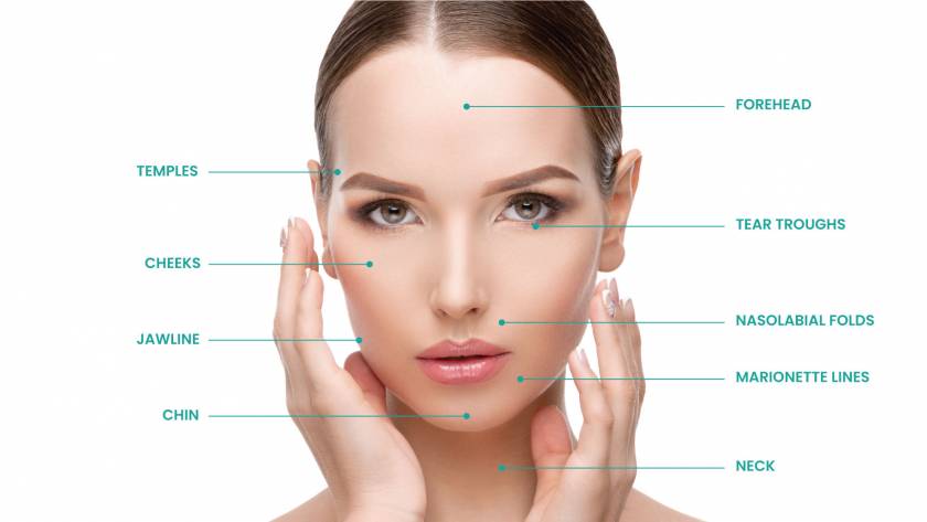 This image shows the treatment area for Aesthefill