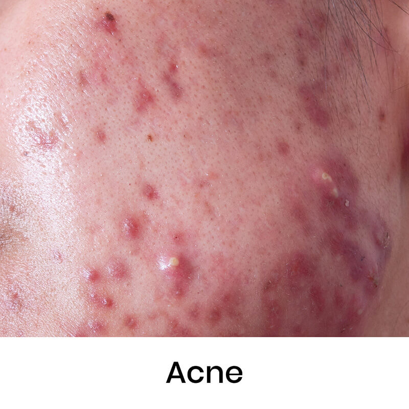 skin-condition-01