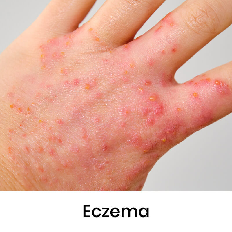 skin-condition-02
