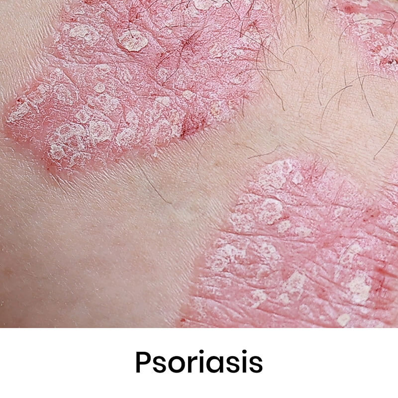 skin-condition-03