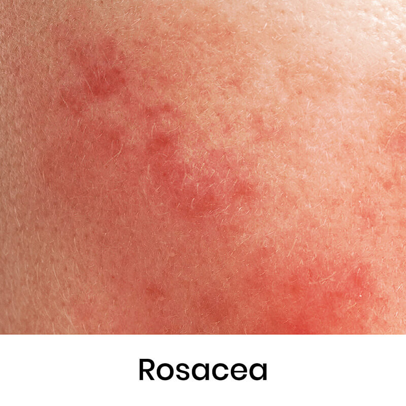 skin-condition-04