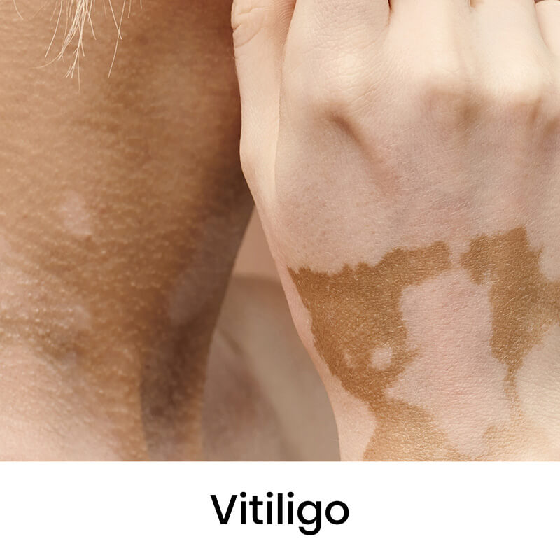 skin-condition-05