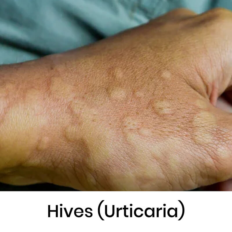 skin-condition-06