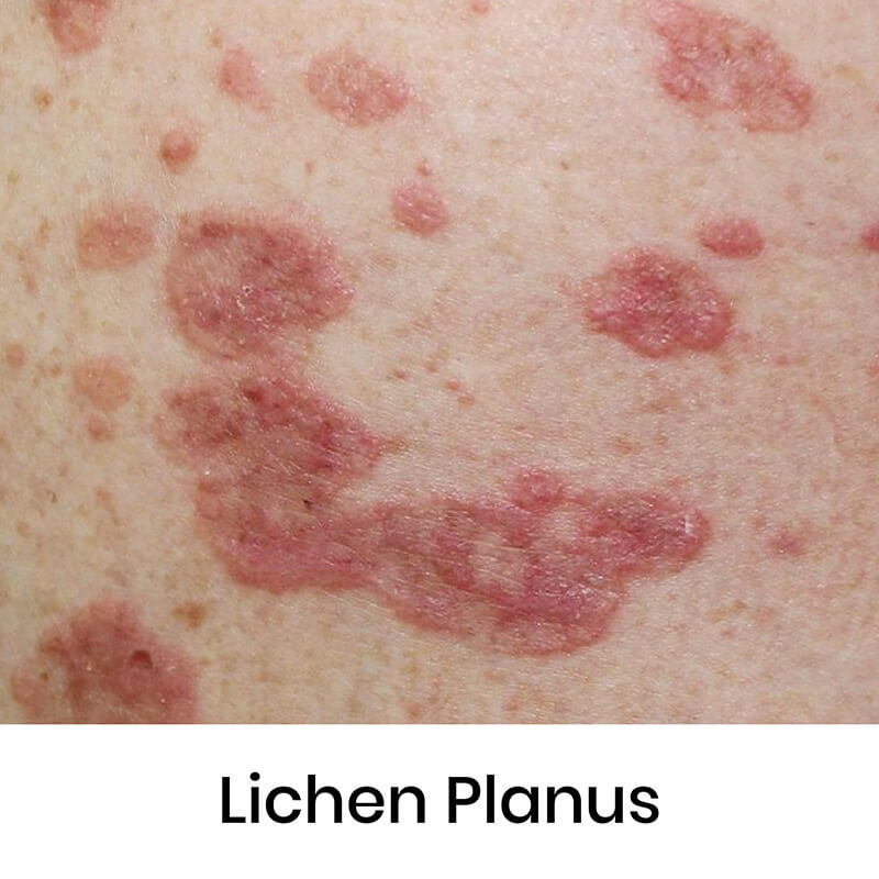 skin-condition-07