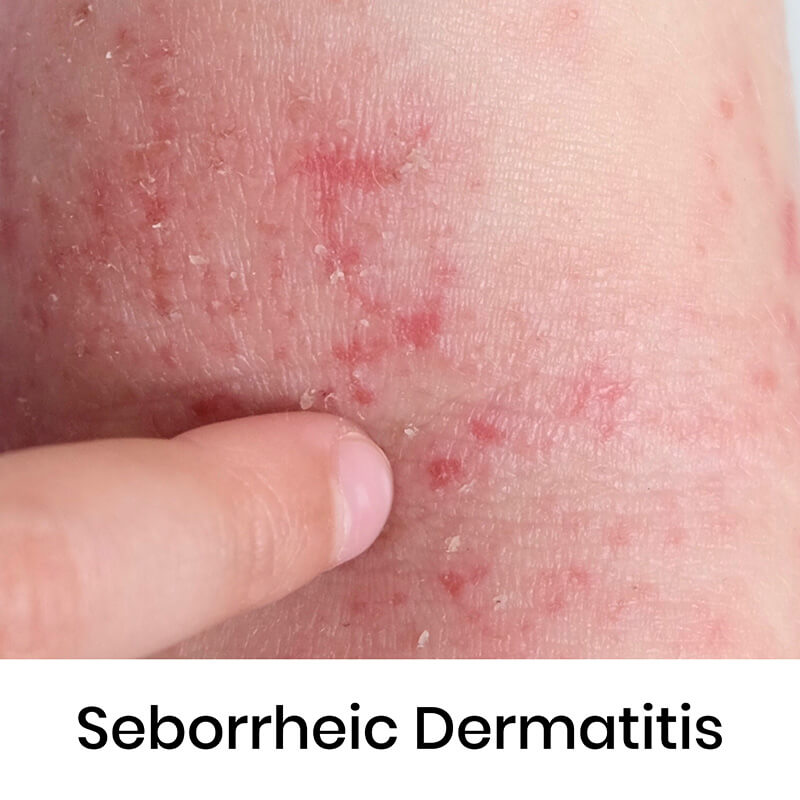 skin-condition-09