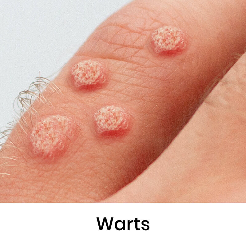 skin-condition-11
