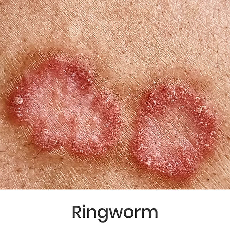 skin-condition-12