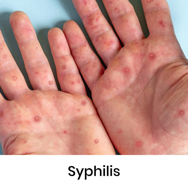 skin-condition-14