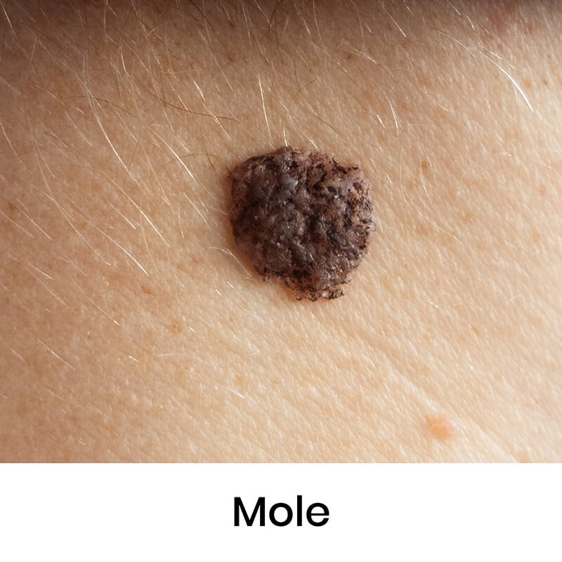 skin-condition-15