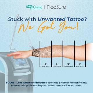MyClinic- Your Trusted and #1 Choice
Bye-bye teenage mistakes 👋

Do you have any tattoos you regret having? Don't worry, the solution is available here in MyClinic with the help of PicoSure Laser 🪄

Our doctors will help you feel brand new. Contact us today for more info & a FREE consultation📱

Bye kesilapan zaman remaja 👋

Anda ada tatu yang ingin dibuang? Jangan risau, penyelesaiannya ada di MyClinic dengan bantuan PicoSure Laser 🪄

Doktor kami akan membantu anda berasa serba baharu. Hubungi kami hari ini untuk maklumat lanjut & konsultasi PERCUMA📱

Damansara Utama | Puchong | Cheras
Melawati | Mount Austin, JB | Bangi | Kelantan | Shah Alam | Sutera Utama, JB
⏰ Monday to Sunday 10.00 am - 6.30 pm

#MyClinic #MyClinicTreatment #picosure #lasermalaysia #tattooremoval