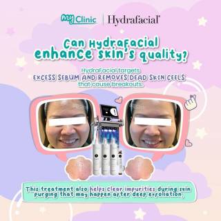MyClinic- Your Trusted and #1 Choice
Experience the rejuvenating power of HydraFacial at MyClinic! 

This deep-cleansing treatment not only hydrates your skin but sets the stage for a month of radiance. 

Remember, the key is in maintenance. Post-treatment, avoid makeup for 24 hours, limit sun exposure, and embrace daily sunscreen and gentle cleansers for that continuous glow until your next monthly visit. 

Book your appointment today and witness the long-lasting effects firsthand! ✨💦

Jom cuba HydraFacial di MyClinic!

Rawatan pembersihan mendalam ini bukan sahaja melembapkan kulit anda tetapi mengekalkan penghidratan untuk kulit berseri.

Ingat, penjagaan kulit lepas rawatan pun penting tau! Lepas facial, elakkan makeup selama 24 jam, kurangkan pendedahan matahari, dan gunakan sunscreen harian dan cleanser lembut untuk kulit kekal berseri sehingga rawatan facial seterusnya.

Tempah temujanji anda hari ini ✨💦

Damansara Utama | Puchong | Cheras
Melawati | Mount Austin, JB | Bangi | Kelantan | Shah Alam | Sutera Utama, JB
⏰ Monday to Sunday 10.00 am - 6.30 pm

#MyClinic #MyClinicPromo #aestheticclinic #aesthetic #aestheticmalaysia #skinclinic #skinclinicmalaysia #klinikkulit #klinikkulitmalaysia #doktorkulitmalaysia #skincare #skindisease #medicalaesthetics #skinaesthetic #antiaging #lipfiller #pigmentation #picolaser #yellowlaser #co2laser #fatfreezing #slimming #rejuran #profhilo #hydrafacial #potenza #emface #thermage #ultherapy