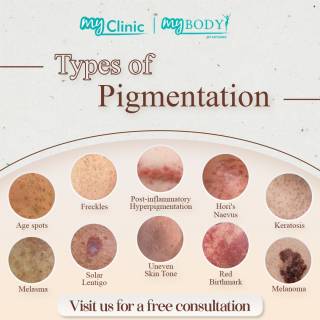 MyClinic- Your Trusted and #1 Choice

Did you know that when it comes to pigmentation? There are 10 types of pigmentation and there is one size fits all solution to cure them. 

It’s form of pigmentations has their own unique and mostly non-invasive way of curing them. Do you want to find out how we can cure yours easily? Drop by or centres to find out more.

Damansara Utama | Puchong | Cheras
Melawati | Mount Austin, JB | Bangi | Kelantan | Shah Alam | Sutera Utama, JB
⏰ Monday to Sunday 10.00am - 6.30pm

#skincare #skin #care #aestheticclinic #beautician #skincareroutine #sales #laser #skincarecommunity