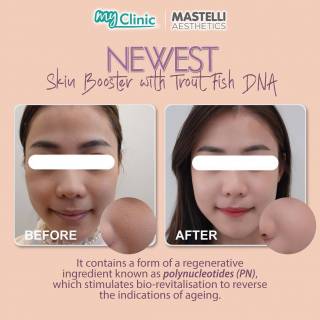 MyClinic- Your Trusted and #1 Choice
Look brand new with NEWEST ✨

Never worry about your increasing age anymore; hydrate and keep your skin healthy with the NEWEST skin booster at MyClinic & you may look forever young 😉

Our doctors will handle your skin with maximum care! Book your appointment today for a FREE consultation 📲

Nampak segar dan sihat dengan NEWEST ✨

Jangan risau tentang usia anda yang semakin meningkat; lembapkan dan sihatkan kulit dengan skin booster NEWEST di MyClinic & anda akan kelihatan muda untuk jangka masa lebih panjang 😉

Doktor kami akan merawat kulit anda dengan sangat rapi! Tempah temujanji anda hari ini untuk konsultasi PERCUMA 📲

Damansara Utama | Puchong | Cheras
Melawati | Mount Austin, JB | Bangi | Kelantan | Shah Alam | Sutera Utama, JB
⏰ Monday to Sunday 10.00 am - 6.30 pm

#MyClinic #NEWEST #SkinBooster