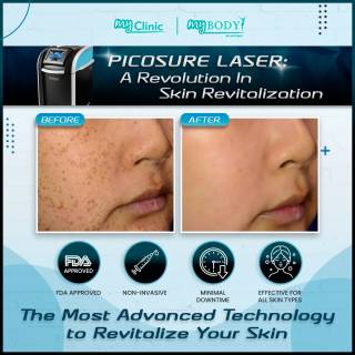 MyClinic- Your Trusted and #1 Choice

"Picture Perfect Skin with PicoSure: Say Goodbye to Imperfections"

Do you avoid cameras because of skin imperfections like dark spots, fine lines, and wrinkles? Say hello to picture-perfect skin with PicoSure, the innovative laser treatment that helps you look your best in every photo.

Don't let skin imperfections hold you back from capturing memories and enjoying life to the fullest. Say goodbye to skin imperfections with PicoSure and say hello to picture-perfect skin!

Damansara Utama | Puchong | Cheras
Melawati | Mount Austin, JB | Bangi | Kelantan | Shah Alam | Sutera Utama, JB
⏰ Monday to Saturday 10.00am - 7.00pm
⏰ Sunday 10.00am - 6.00pm

#skincare #skin #care #aestheticclinic #beautician #skincareroutine #sales #laser #skincarecommunity