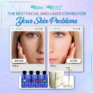 MyClinic- Your Trusted and #1 Choice

Get a Flawless Complexion with the Best Facial and Laser Treatments!

Do you struggle with skin problems such as wrinkles, fine lines, acne, hyperpigmentation, or uneven skin tone? 

At MyClinic, we offer a wide range of facial and laser treatments to help you address a variety of skin concerns. 

No matter what skin problems you're dealing with, we have the expertise and technology to help you achieve your best skin ever. Book your appointment at MyClinic today and get ready to say goodbye to skin problems and hello to a beautiful, glowing complexion!

Damansara Utama | Puchong | Cheras
Melawati | Mount Austin, JB | Bangi | Kelantan | Shah Alam | Sutera Utama, JB
⏰ Monday to Sunday 10.00 am - 6.30 pm

#skincare #skin #care #aestheticclinic #beautician #skincareroutine #sales #laser #skincarecommunity