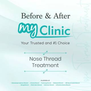 MyClinic- Your Trusted and #1 Choice
Enhance your nose effortlessly with nose threading treatment at MyClinic! ✨ 

Experience the benefits of a lifted nose tip, improved contour, and a slimmer nose bridge. Our minimally invasive procedure offers minimal downtime, allowing you to enjoy your results quickly. 

Achieve better definition and reduced width of your nose with our expert threading technique. Book your consultation at MyClinic and unlock your nose's full potential! 

Bentukkan hidung anda dengan rawatan nose threading di MyClinic! ✨

Dapatkan hidung tampak lebih mancung dan batang hidung yang lebih tinggi. Prosedur invasif minimum kami menawarkan masa pemulihan yang singkat, membolehkan anda mendapatkan hasil rawatan dengan cepat.

Tempah konsultasi anda di MyClinic untuk hidung yang lebih cantik!

Damansara Utama | Puchong | Cheras
Melawati | Mount Austin, JB | Bangi | Kelantan | Shah Alam | Sutera Utama, JB
⏰ Monday to Sunday 10.00 am - 6.30 pm

#MyClinic #MyClinic #MyClinicTreatment #MyClinicPromo #sale #aesthetickl #aestheticclinic #aesthetic #aestheticmalaysia #skinclinic #skinclinicmalaysia #klinikkulit #klinikkulitmalaysia #doktorkulitmalaysia #skincare #skindisease #medicalaesthetics #skinaesthetic #antiaging #lipfiller #nonsurgical #pigmentation #picolaser #yellowlaser #co2laser #fatfreezing #hairgrowth #slimming #rejuran #profhilo
