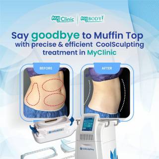 MyClinic- Your Trusted and #1 Choice
Worry less about muffin tops, rock your favourite jeans (and cropped top) with CoolSculpting at MyClinic! 🌟 

Consult with us to target and measure those stubborn areas, freeze away the fat, and watch for up to 25% reduction. No downtime, freeze it and get back to conquering the day! ❄️💙 

Book a session with us today to look fab like a celeb!

Gayakan seluar jeans kegemaran anda tanpa lemak berlebihan dengan CoolSculpting di MyClinic! 🌟

Dapatkan konsultasi untuk target & ukur kawasan berlemak degil; kemudian, bekukan lemak & alami pengurangan lemak sehingga 25%. Tiada masa pemulihan, bekukannya dan kembali kepada aktiviti harian! ❄️💙

Tempah sesi dengan kami hari ini untuk kelihatan hebat bak selebriti!

Damansara Utama | Puchong | Cheras
Melawati | Mount Austin, JB | Bangi | Kelantan | Shah Alam | Sutera Utama, JB
⏰ Monday to Sunday 10.00 am - 6.30 pm

#MyClinic #MyClinicPromo #aestheticclinic #aesthetic #aestheticmalaysia #skinclinic #skinclinicmalaysia #klinikkulit #klinikkulitmalaysia #doktorkulitmalaysia #skincare #skindisease #medicalaesthetics #skinaesthetic #antiaging #pigmentation #picolaser #yellowlaser #co2laser #fatfreezing #hairgrowth #slimming #rejuran #profhilo #hydrafacial #potenza #emface #thermage #ultherapy